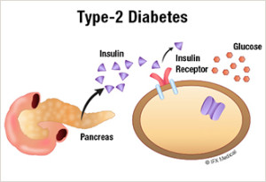 type_2_diabetes